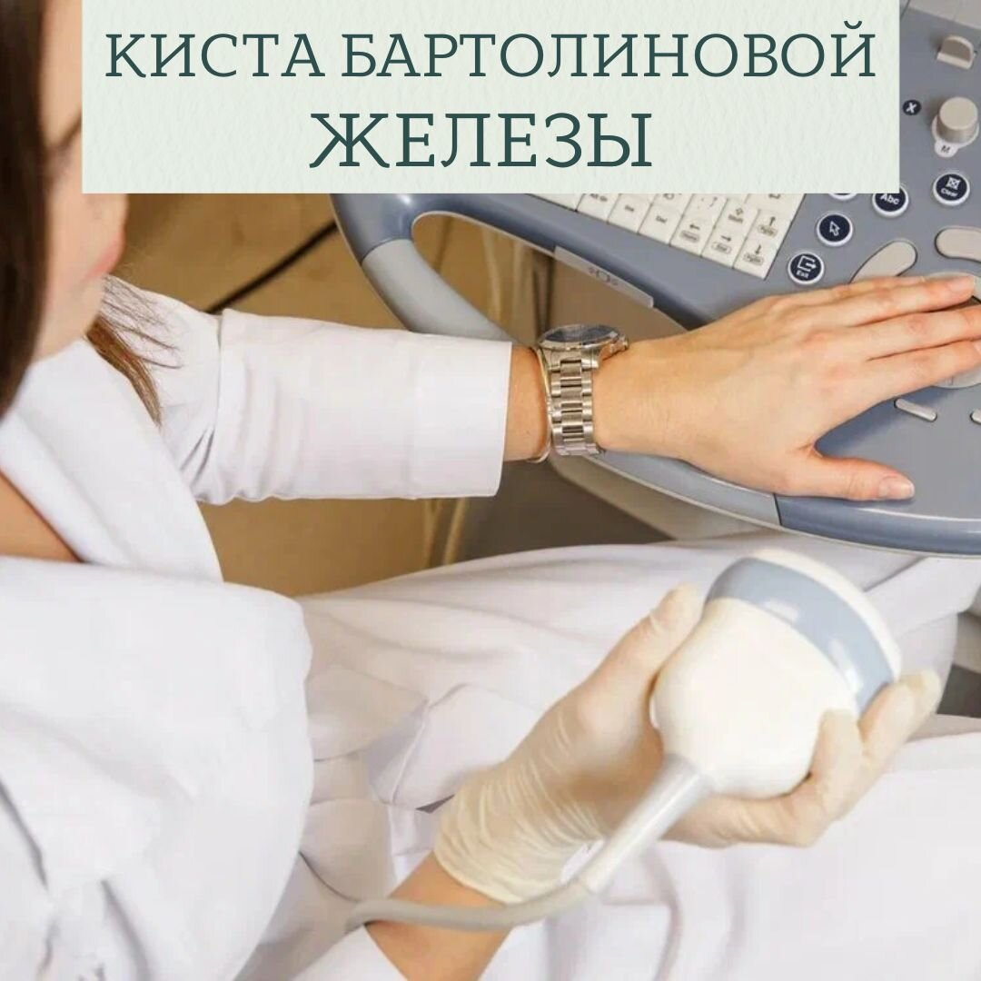 Серьезной проблемой для женщины может стать киста бартолиновой железы, образование в области гениталий.