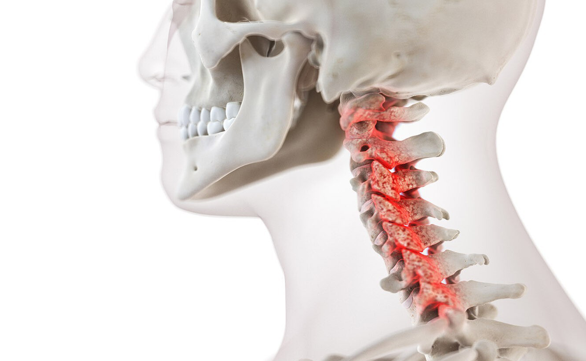 Грыжи шейного отдела еще опаснее, чем поясничные | Клиника «Тибет» | Дзен
