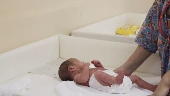     В течение 2023 года в Тюменской области родились шесть детей с нарушением формирования пола. Это редкая патология, когда наружные и внутренние половые органы не соответствуют ни женскому, ни мужскому полу.