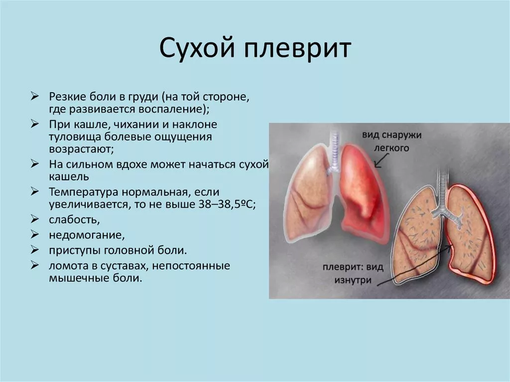 Боль спереди под