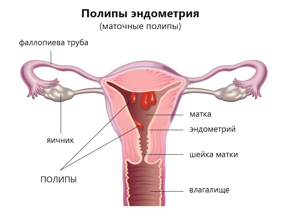 Эндометрий в полости матки