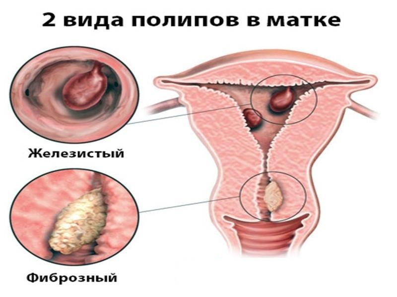 Анатомия женских половых органов. Киев, Печерск | 