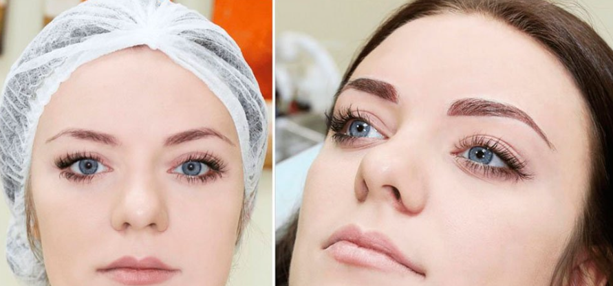 Ошибки при удалении перманента бровей лазером – Telegraph