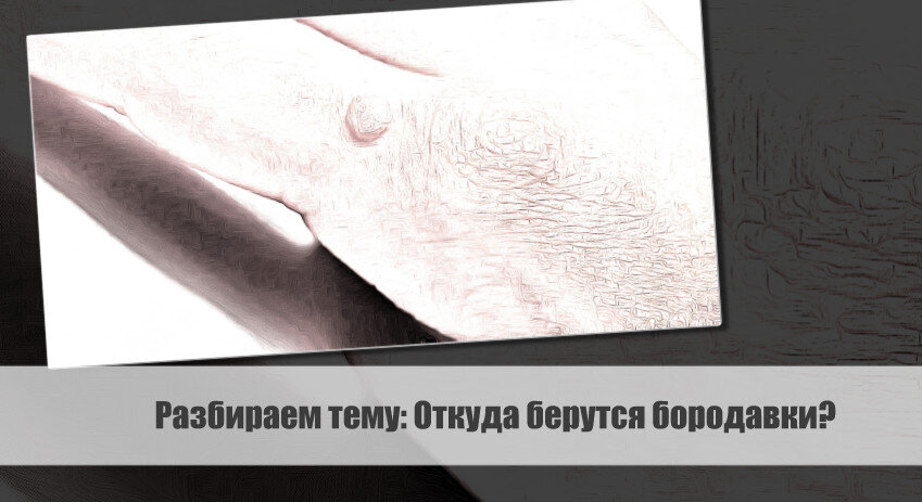 Разбираем тему: Откуда берутся бородавки?