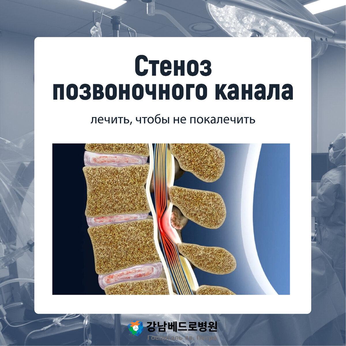 Стеноз позвоночного канала норма. Абсолютный стеноз позвоночного канала что это. Стеноз позвоночного канала поясничного. Стеноз позвоночного канала. Стеноз позвоночника мрт.