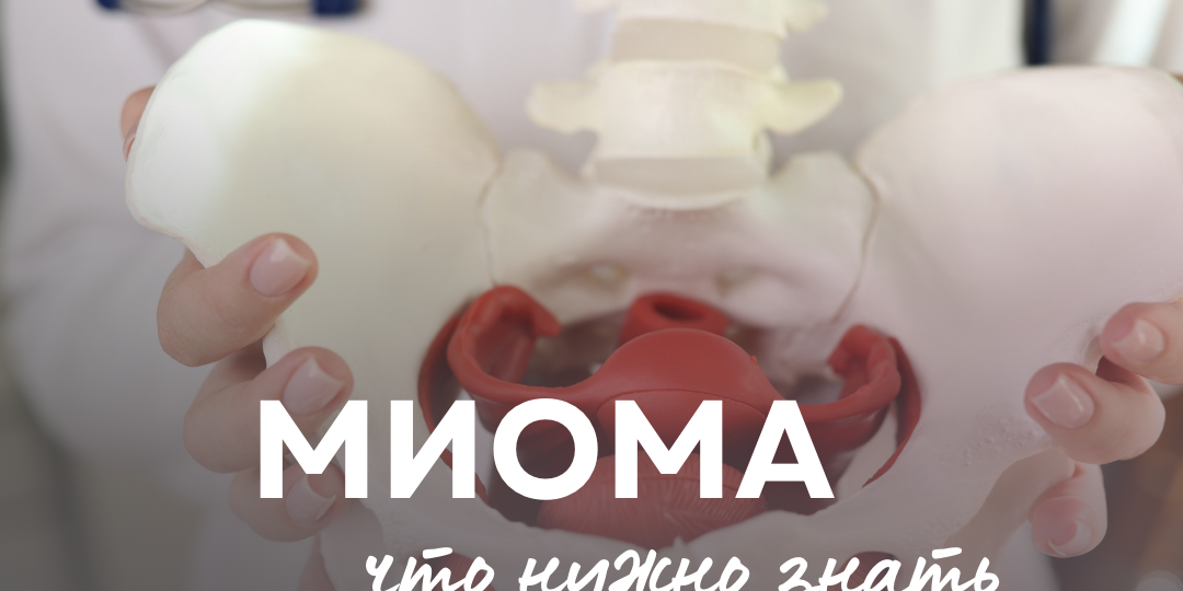 Миома-о чем вы спрашивали