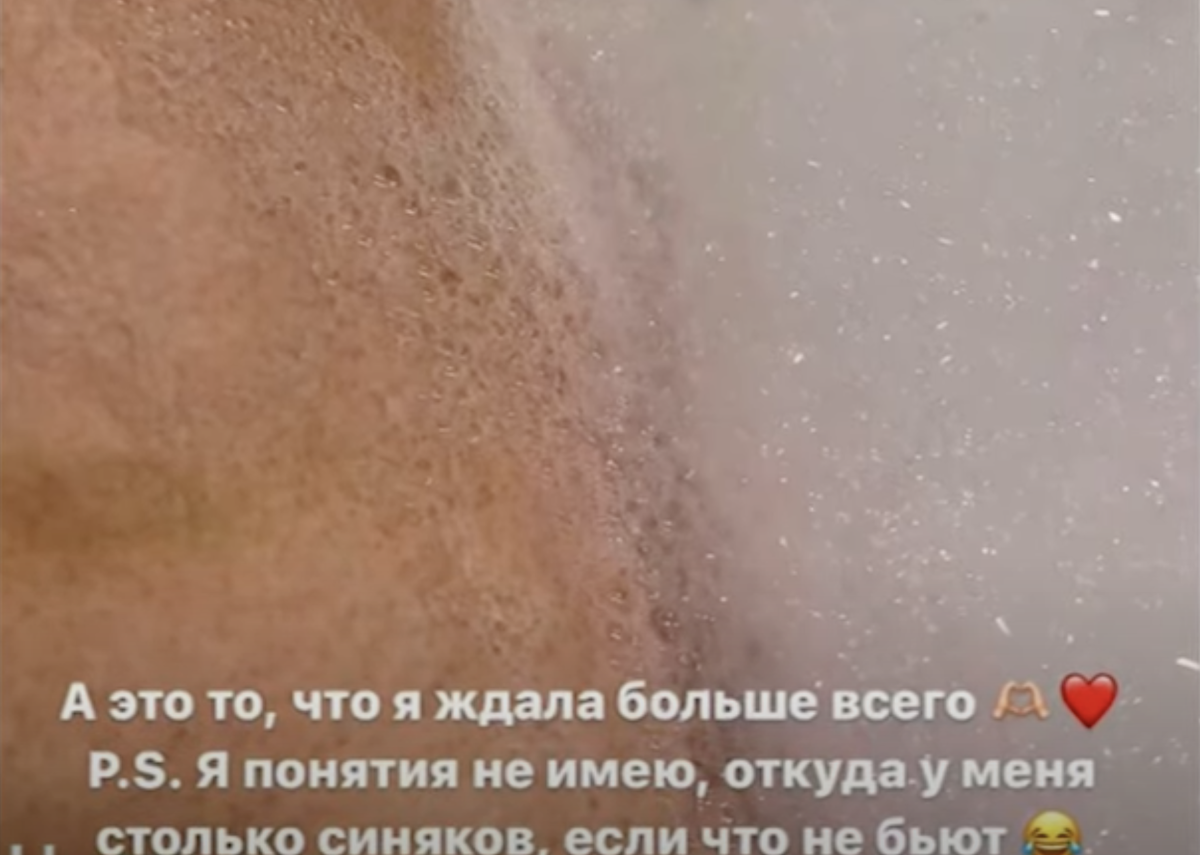 -10