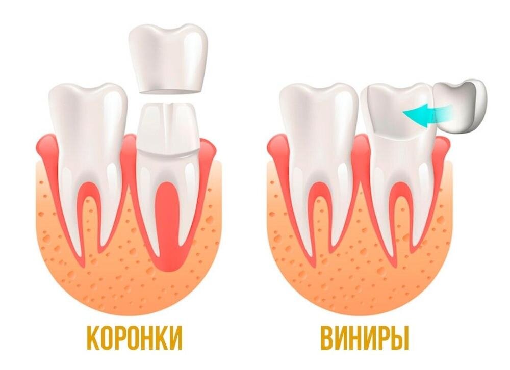 Темнеющего разбор