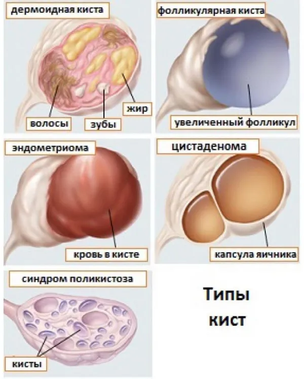 Не лопнул фолликул(