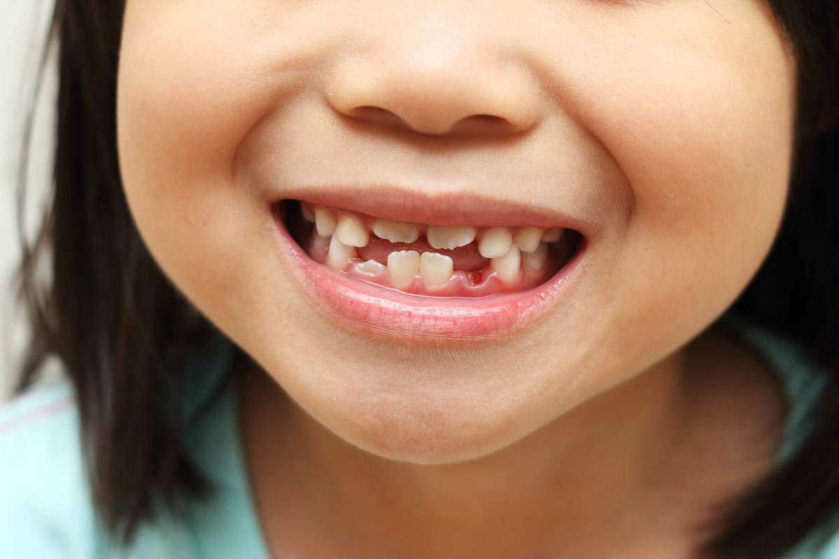 Коренные зубы у детей.