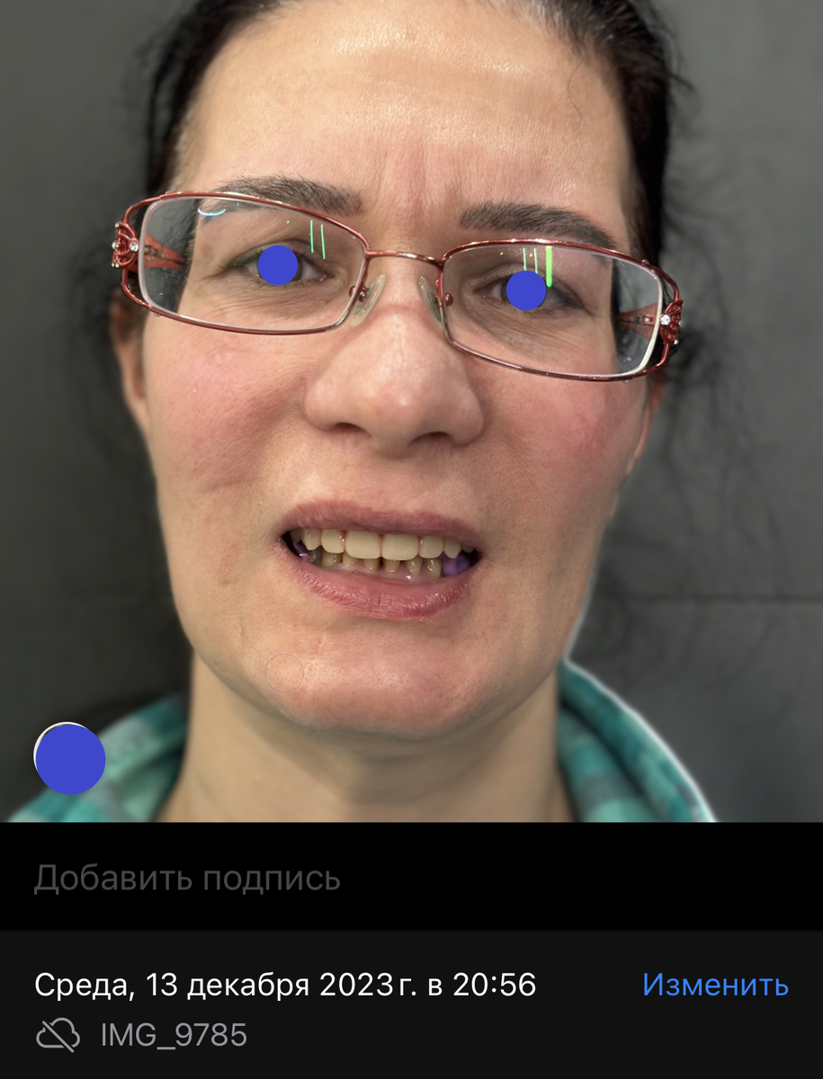Кто рожал с артритом. Полиартрит: симптомы и лечение, осложнения полиартрита рук ≡ Лечение артрита • лечение ревматоиодного артрита в Киеве - цена. Ревматический артрит симптомы и лечение: Клинические рекомендации