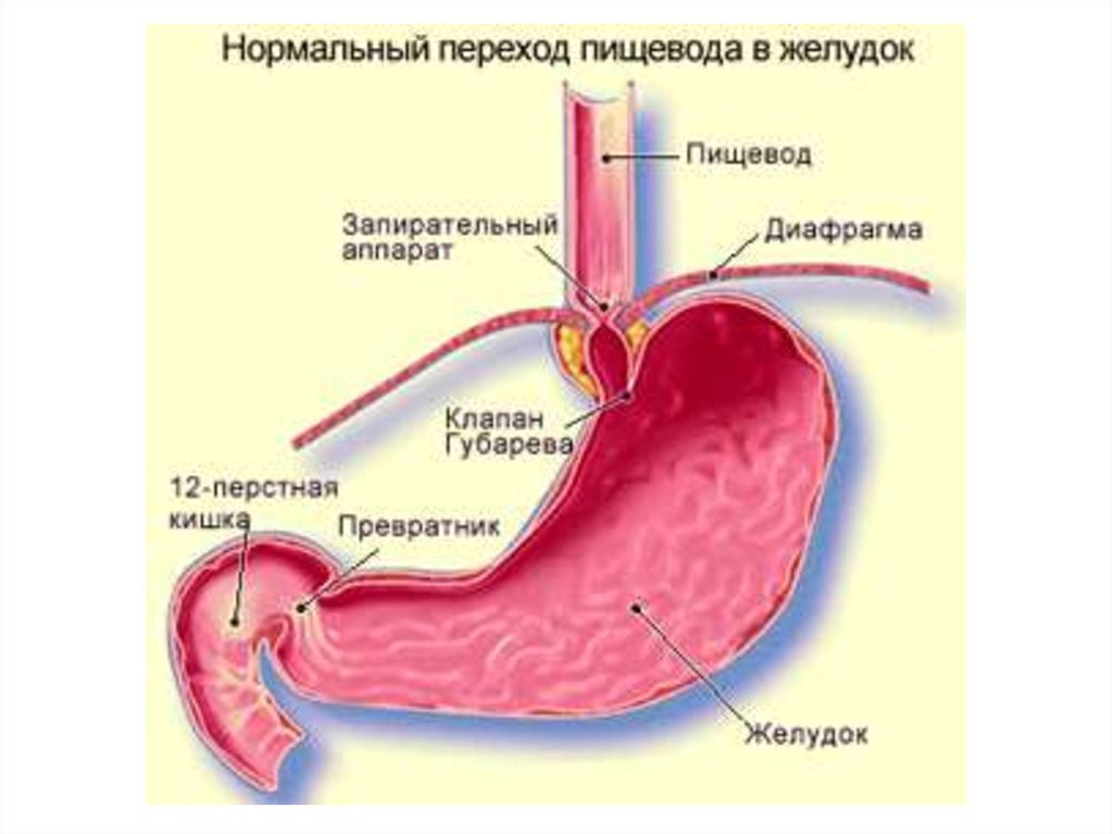 Что такое рефлюкс? Каковы методы лечения?