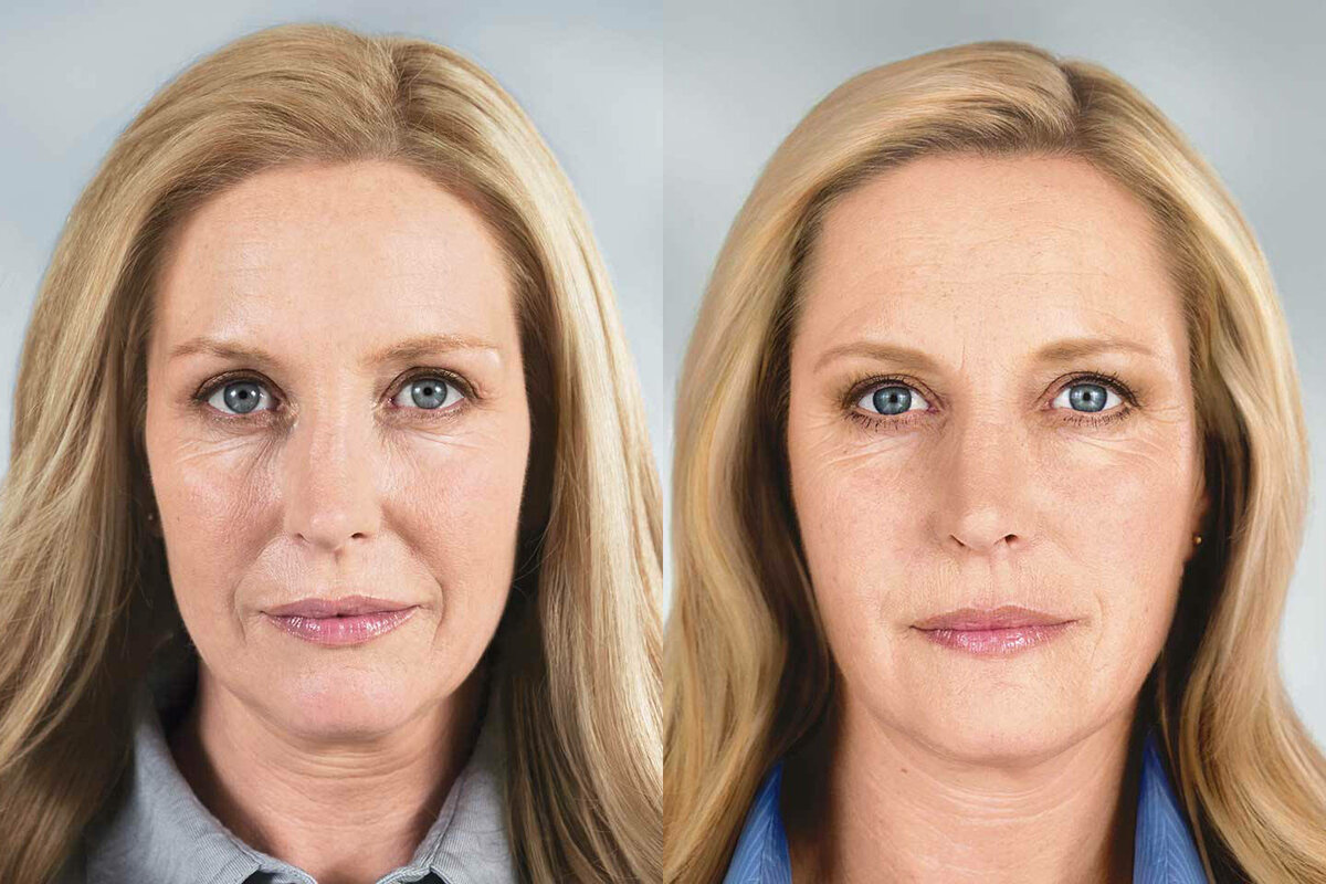 Фотография взята из источника yandex.ru