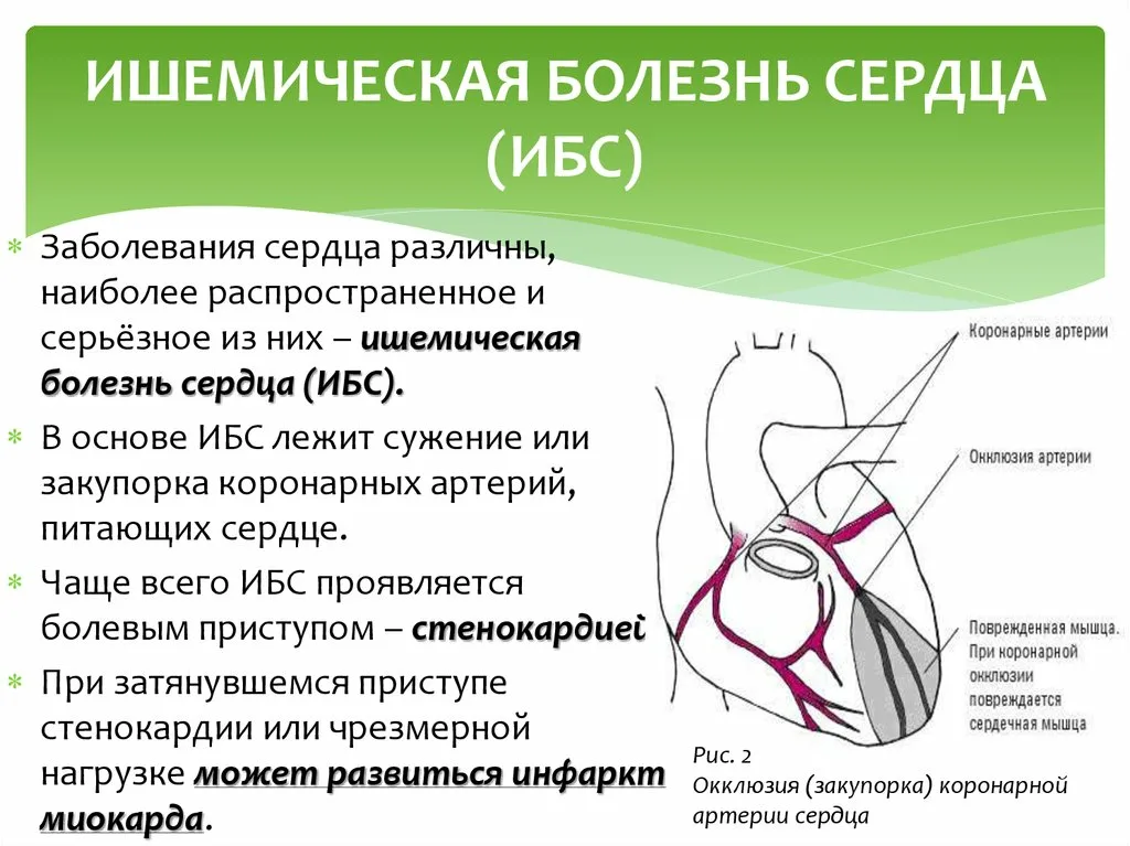 Ишемическое сосудистое заболевание