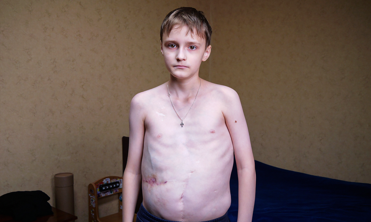 Илья Бусаров, подопечный фонда "Алёша"