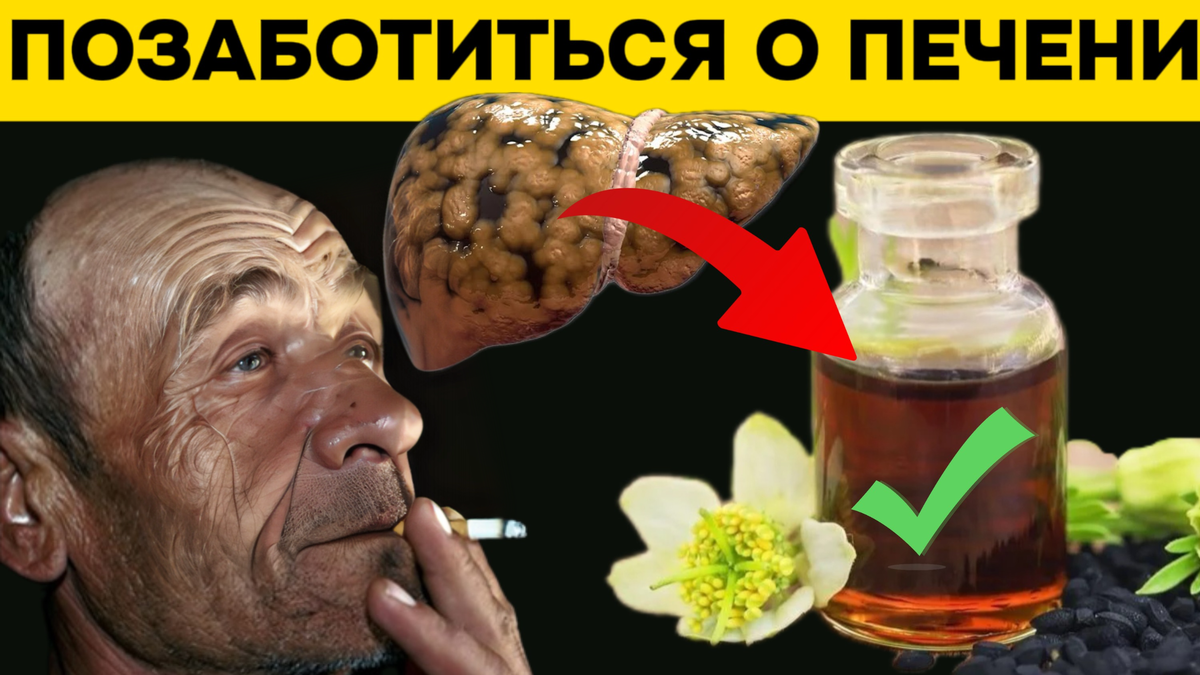 Гепатоцеллюлярный карценома. Печень 50. Тиреотоксический гепатоз. Печень 50. Жировой гепатоз печени лечится.