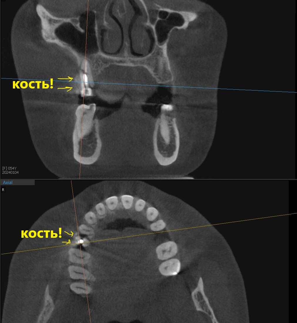 Зубы это кости или нет