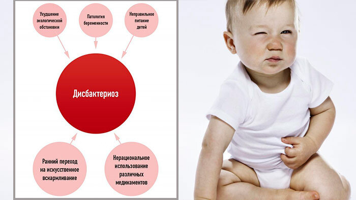 Дисбактериоз, недоношенность ребенка и пробиотики