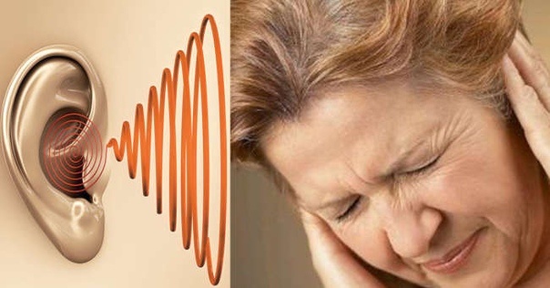 Шум в ушах: когда и как звенит? Учимся искать причину