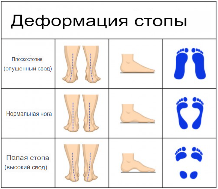 Как определить стопы