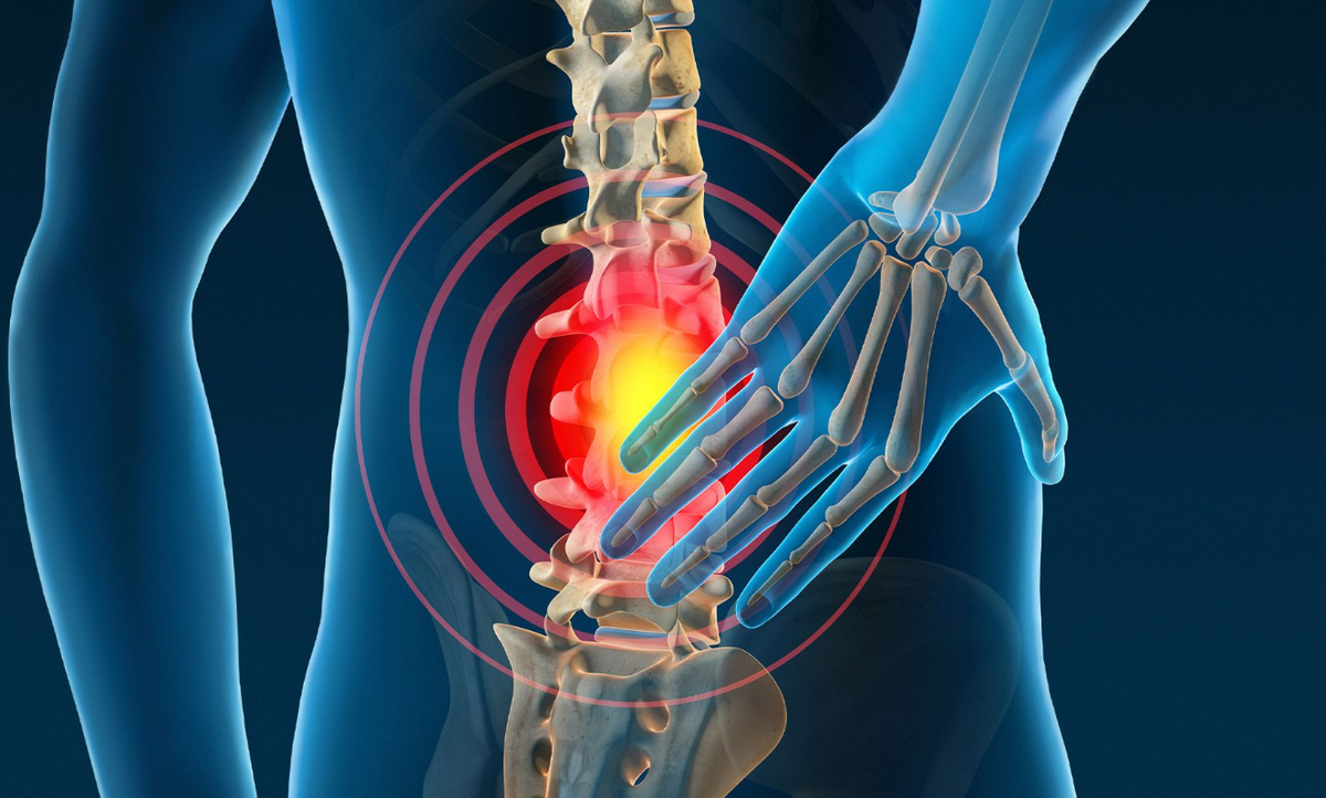 Боль в пояснице не разогнуться. Проблемы с позвоночником. Spinal Cord images. Cervical Pain.