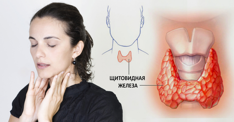 Первые признаки щитовидной железы у женщин