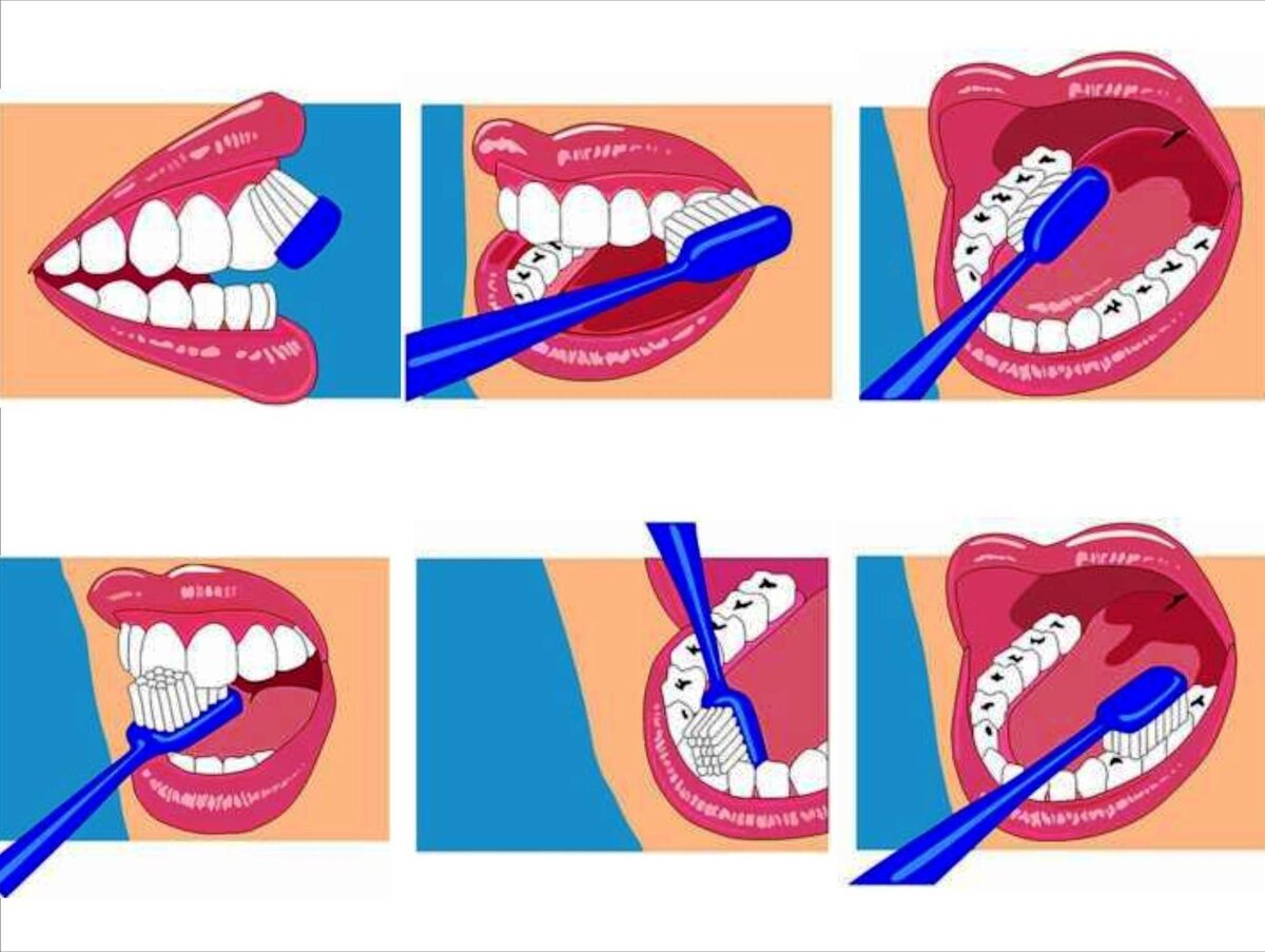 Уход за полостью рта после. Схема как правильно чистить зубы для детей. Правельна схема чистки зубов. Правильная методика чистки зубов зубной щёткой. Гигиена зубов схема.