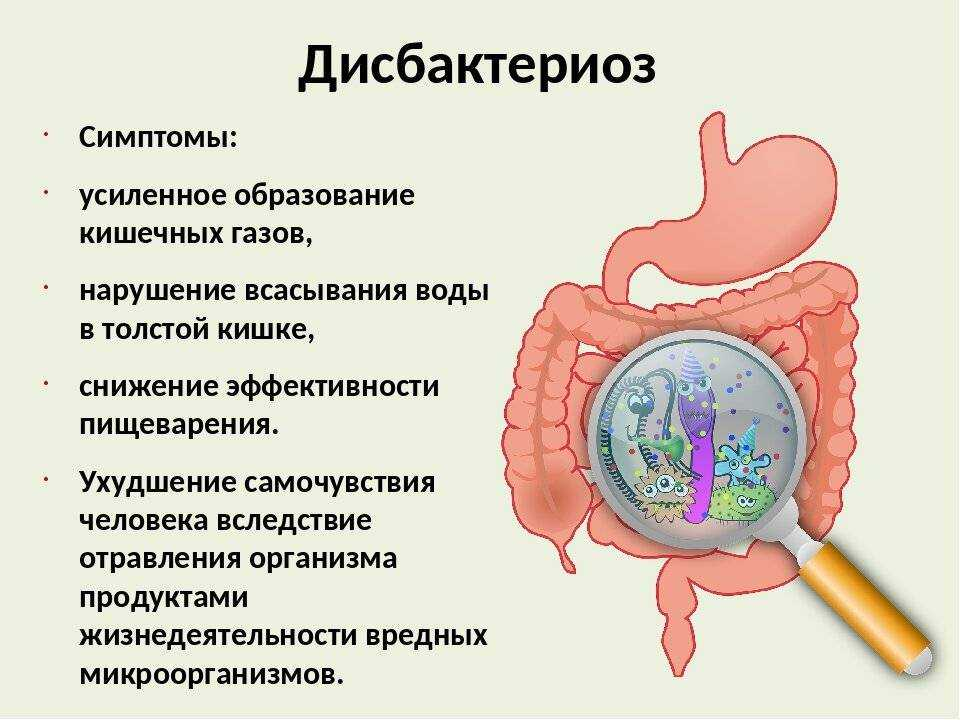 Дисбактериоз анализ