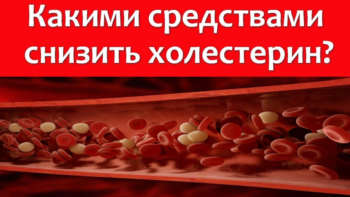 Способы понижения холестерина. Холестериноснижающие препараты. Таблетки для понижения холестерина.