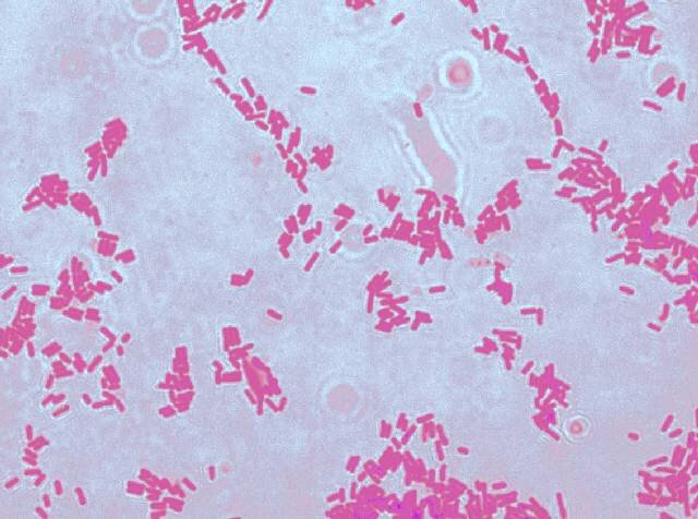 Часы со стрелками показыва. Тормозной путь автомобиля движущегося со скоростью 120. Скорость реакции равна. Через сколько минут секундная стрелка. Часы пятнадцать минут десятого.