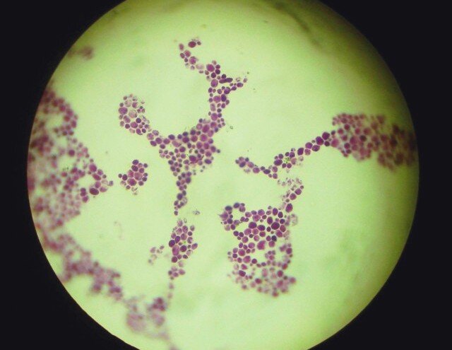 Trichophyton микроскопия. Trichophyton rubrum микробиология. микоз кожи микроскопия. грибок микроскопия. Trichophyton equinum микроскопия.