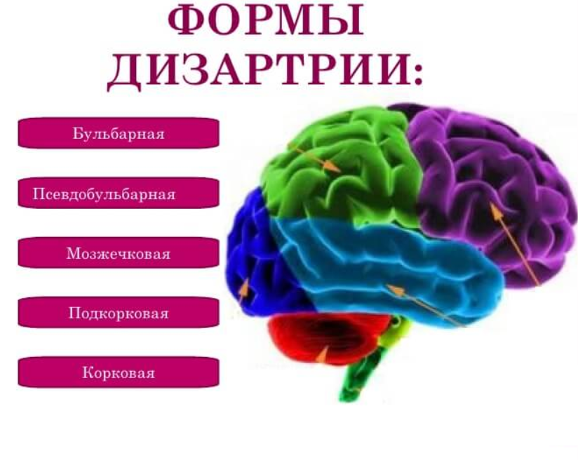 Дизартрия это расстройство. Дизартрия. Формы псевдобульбарной дизартрии. Нарушение речи дизартрия. Формы дизартрии у детей.