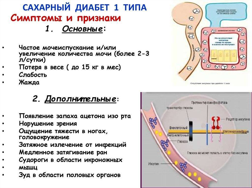 Клиника сахарного диабета 1 типа. Симптомы сахарного диабета 1-го типа. СД 1 типа инсулин. Основными клиническими симптомами сахарного диабета 1 типа.