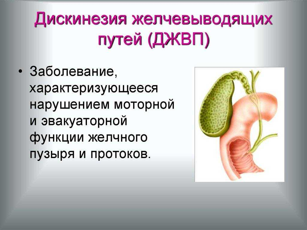 Симптомы желчного пузыря у детей. Эндоскопические признаки джвп. Болезни желчного пузыря патология. Заболевание дискинезия желчевыводящих путей. Дискинезия желчных путей.