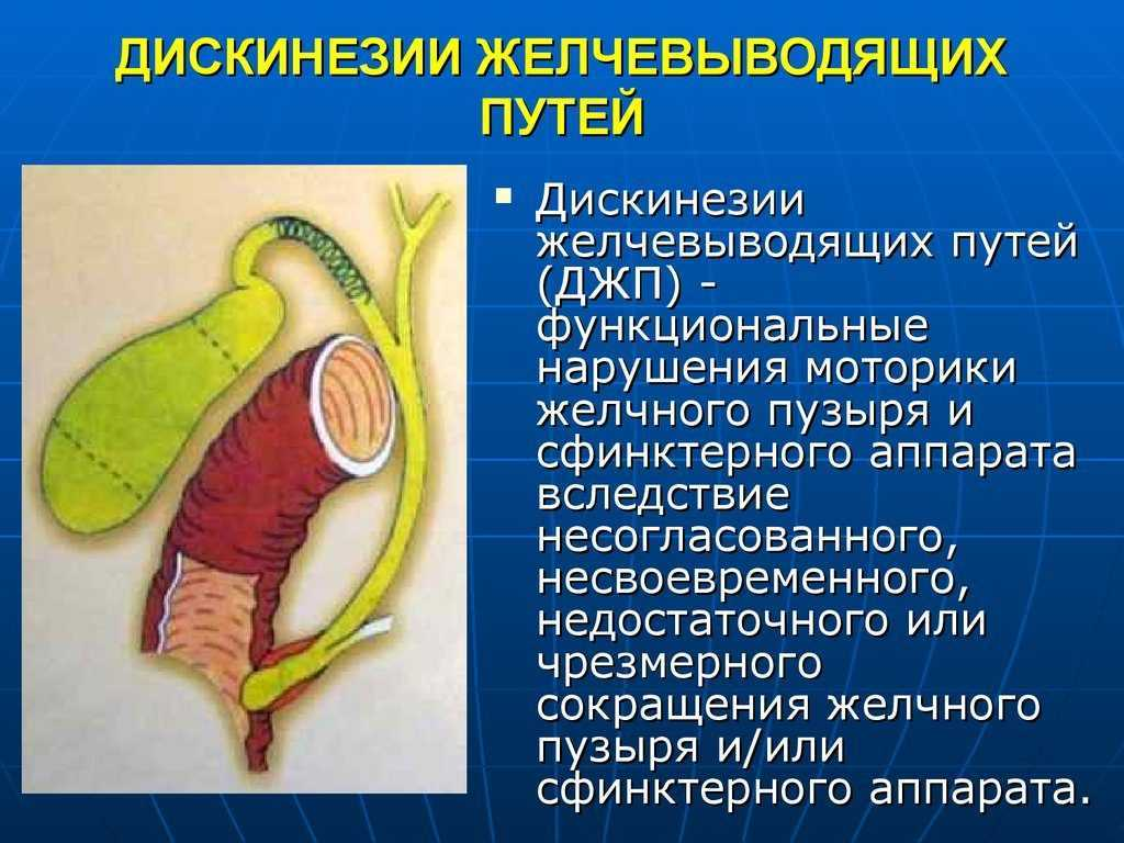 Желчевыводящих путей что это такое. Нарушение функций желчевыводящих путей. Заболевание дискинезия желчевыводящих путей. Дискинезия желчевывод путей. Дискинезия желчного пузыря.