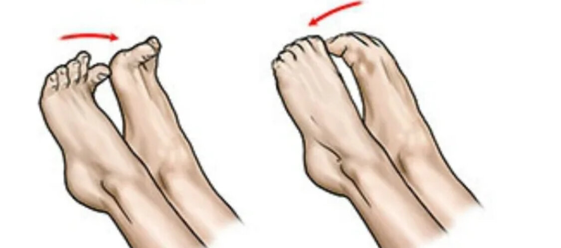 Судороги стопы и пальцев ног. Судорогоа пальцев ноги. Упражнения для мизинца стопы.