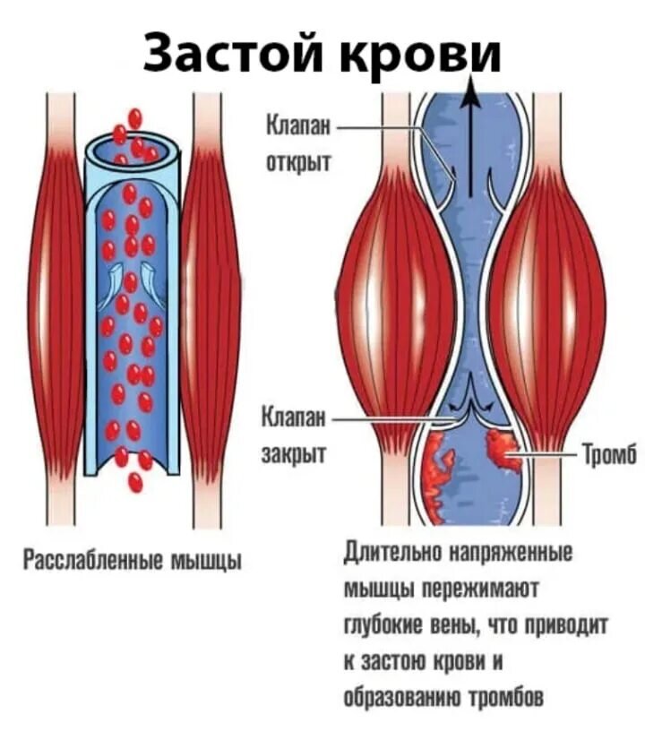 Матка при третьей беременности