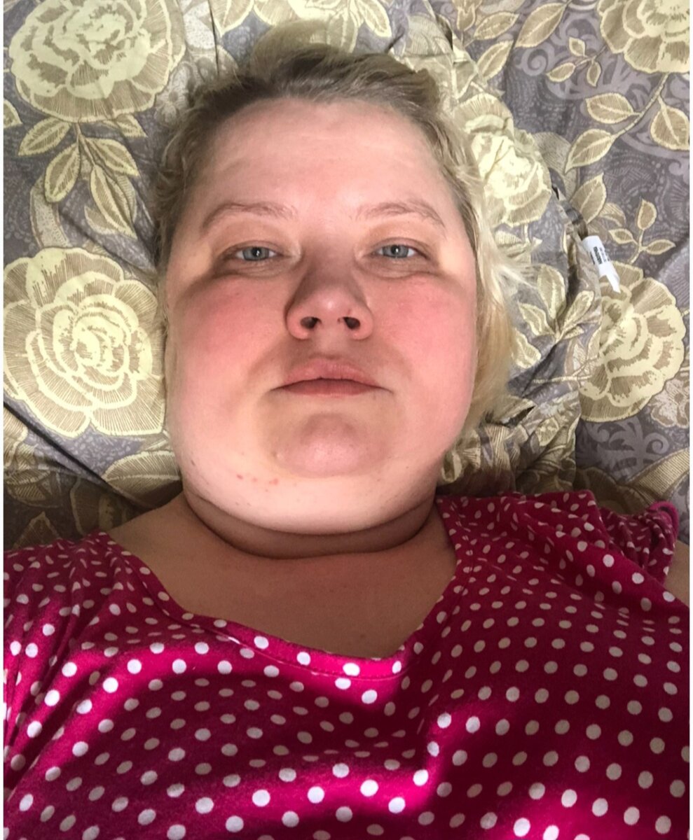 ###ть и к этому ещё опухоль в голове и вот как жить то мне с этим в ...