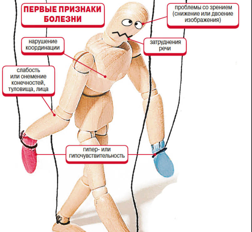 Рассеянный склероз - лечение в клинике или народными средствами