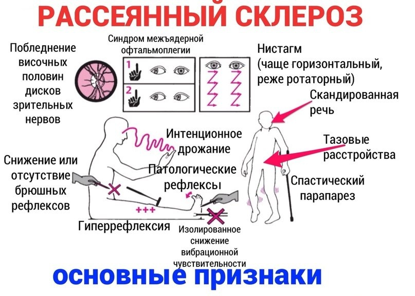 Люди с рс