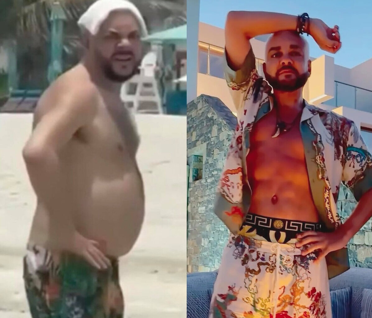 Фото: Филипп Киркоров до и после похудения