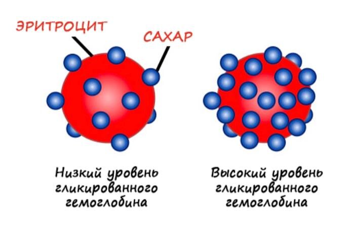  Врачи часто назначают ГГ пациентам с диабетом. Он помогает получить более четкую картину среднего уровня сахара в крови в течение последних трех месяцев.