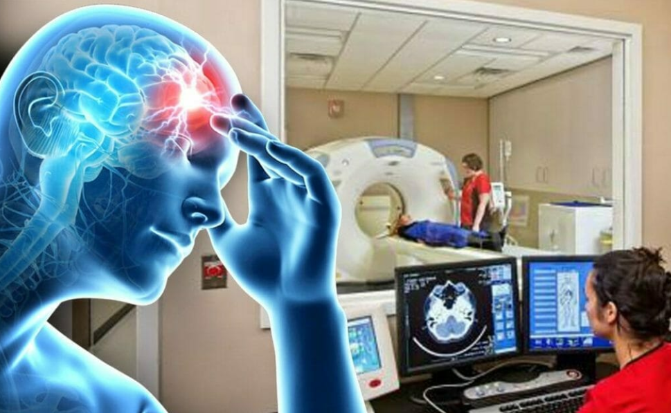 Классификация нейрологии. Основные неврологические синдромы поражения головного мозга. И. Неврология национальное руководство гусев 2018. Прием невролога.