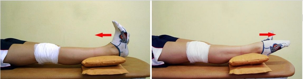 Разрабатываем ногу после операции. Валики для коленных суставов. Валик под голеностопным суставом. Контрактура коленного сустава упражнения.