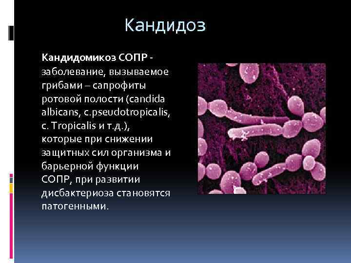 Кандидоз кожи симптомы фото Кандидоз кишечника пошагово