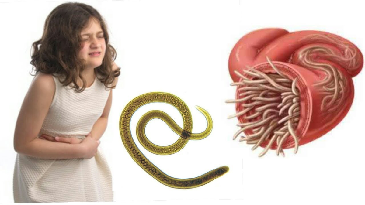 Признаки червей в организме человека. Паразиты черви аскариды. Черви паразиты Острица. Гельминты острицы аскариды.