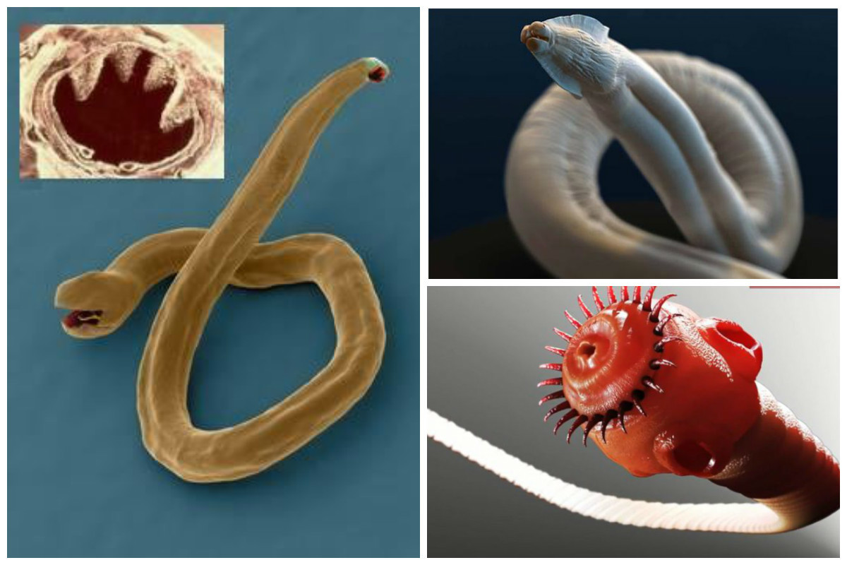 A. аскаридоза и дифиллоботриоза. Гельминты паразитические черви. Черви паразиты Острица. Гельминты паразитические черви у человека. Новые черви