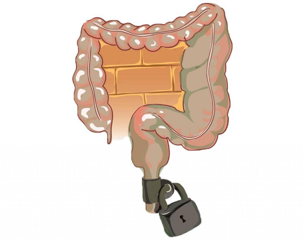 Запор после анального секса - Проктология - - Здоровье венки-на-заказ.рф