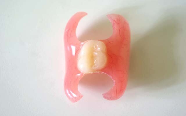 036. Протезы на жевательные зубы. Частичный съемный протез flexi n512. Адаптационный съемный протез. Как снять съемный зубной протез.