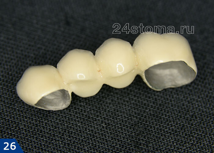 Акри фри зубные протезы. Зубной протез своими руками. Старые полные съемные протезы. Что такое корректировка зубных протезов. Нейлоновый микропротез 1-3.